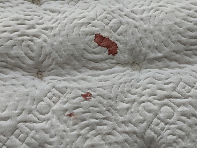 Cách tẩy vết máu khô trên ga giường đơn giản mà hiệu quả tại nhà